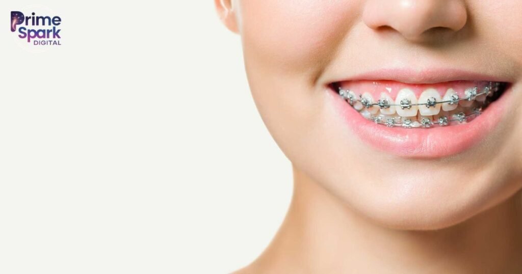 What Are Braces and Who Needs Them?